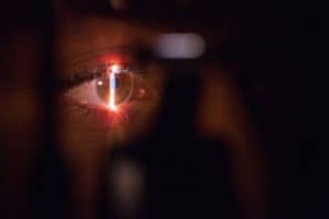 Person with light beam examining eye