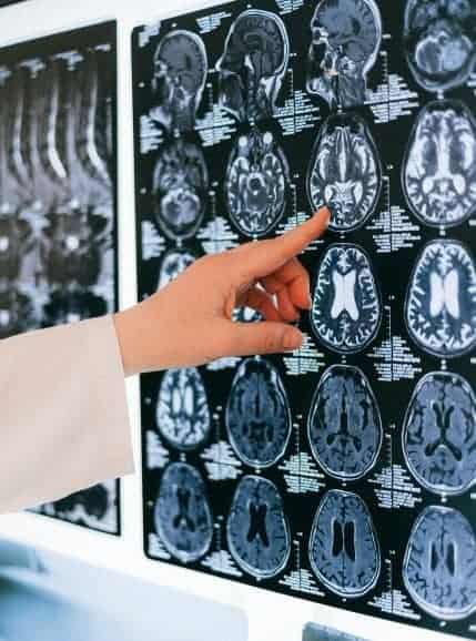 Finger pointing to pictures of a brain from an MRI scan.